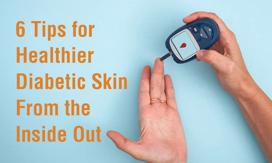 6 Tips for Healthier Diabetic Skin From the Inside Out