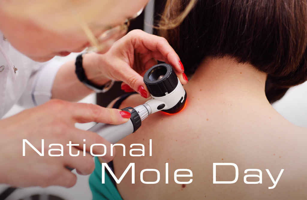 Is This Mole Cancerous? Learn the ABCDE and F’s of Melanoma